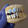 925 Sterling Silver Vampire Fangs Custom Grillz