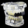 Black Bling Micro Pave Iced Flooded Out Top Grillz