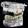 Black Bling Micro Pave Iced Flooded Out Top Grillz