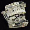 Black Plated Eight Tooth Bottom Teeth Grillz