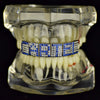 Blue Letters Personalized Iced Flooded Out Teeth Custom Name Grillz