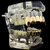 Cartel Gold Finish Vampire Fangs Grillz Set