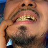 Gold Plated 925 Sterling Silver Diamond Dust Diamond-Cut Custom Grillz