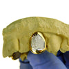 Gold Plated over 925 Silver 2-Tone Diamond Dust Custom Caps Single Grillz