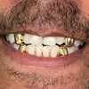 Gold Plated over 925 Silver 4 Single Caps w/Back Bars Custom Grillz