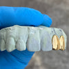 Gold Plated over 925 Silver Double Side Canine Custom Grillz