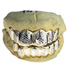 Gold Plated over 925 Silver Two-Tone Diamond-Cut Custom Grillz