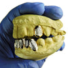 Gold Plated over 925 Silver Two-Tone Diamond Dust 2/6 Custom Grillz