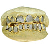 Gold Plated over 925 Silver Two-Tone Diamond-Dust Custom Grillz