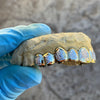 Gold Plated over 925 Silver Two-Tone Diamond-Dust Custom Grillz