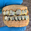 Gold Plated over 925 Silver Two-Tone Diamond-Dust Custom Grillz