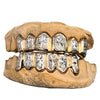 Gold Plated over 925 Silver Two-Tone Diamond Dust Starburst Custom Grillz