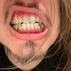 Gold Plated over 925 Sterling Silver Custom Canine Caps Teeth Grillz