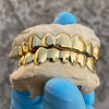 Gold Plated over Solid 925 Sterling Silver Plain Custom Grillz