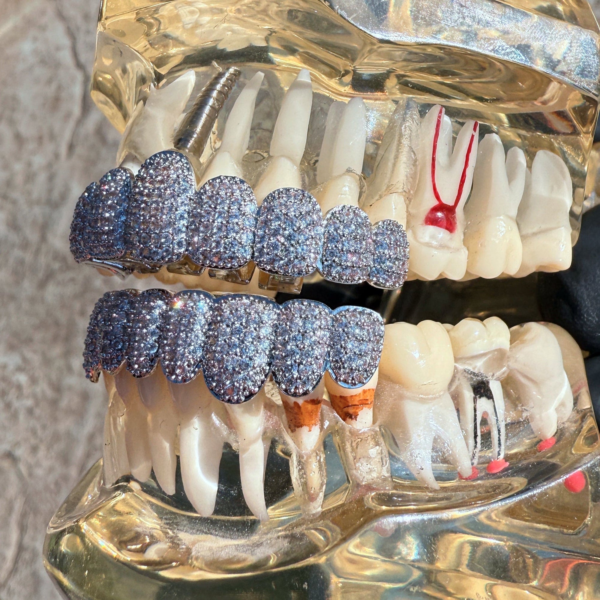 Grillz Set 10 Top Teeth & Ten Bottom Big Front Tooth Iced CZ Bling Gri