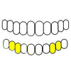 Lower RIght And Left Set (21/22 & 27/28) 10K Gold Double Open/Solid Custom Caps (Canine & 1st Premolar)