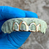 Real 10K Gold All Open Face Hollow Custom Grillz