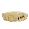 Real 10K Gold Double Caps Side Canine Custom Grillz