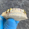 Real 10K Gold Double Caps Side Canine Custom Grillz