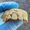 Real 10K Gold Double Caps Side Canine Custom Grillz