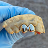 Real 10K Gold Double Caps Side Canine Custom Grillz