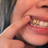 Real 10K Gold Double Side Canine Open Face Caps Custom Grillz