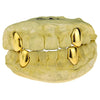 Real 10K Gold Four Single Caps w/Back Bars Custom Grillz