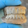 Real 10k Gold Full Diamond-Dust Custom Teeth Grillz