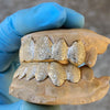 Real 10k Gold Full Diamond-Dust Custom Teeth Grillz