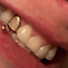 Real 10K Gold Open Face Canine Custom Tooth Cap Single Grillz