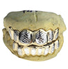 Real 10K Gold Two-Tone Diamond-Cut Custom Grillz