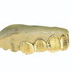 Real 10K Solid Gold Diamond Dust Custom Grillz