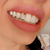 Real 10K Solid Gold Open Face Single Cap Grillz (Choose Any Tooth)