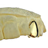 Real 10K Solid Gold Single Cap Custom Grillz (Choose Any Tooth)