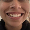 Real 10K Solid Gold Single Cap Custom Grillz (Choose Any Tooth)