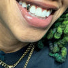 Real 10K Solid Gold Single Cap Custom Grillz (Choose Any Tooth)