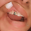 Real 10K Solid Gold Single Cap Custom Grillz (Choose Any Tooth)