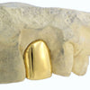 Real 10K Solid Gold Single Cap Custom Grillz (Choose Tooth)