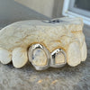 Real 10K White Gold Double Side Canine Open Face Caps Custom Grillz