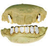 Real 14k Gold Two-Tone Diamond Dust 2/6 Custom Grillz