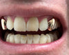 Real 14K Rose Gold Single Cap Custom Grillz (Choose Tooth)