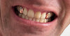 Real 14K Rose Gold Single Cap Custom Grillz (Choose Tooth)