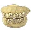 Real 14K Solid Gold Diamond-Cut Diamond Dust Custom Grillz