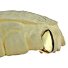 Real 14K Solid Gold Single Cap Custom Grillz (Choose Tooth)