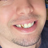Real 14K Solid Gold Single Cap Custom Grillz (Choose Tooth)