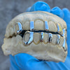 Real 925 Sterling Silver Gap Bars w/Open Face Teeth Custom Grillz