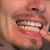 Real 925 Sterling Silver Three Tooth Side Teeth Custom Grillz