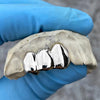 Real 925 Sterling Silver Three Tooth Side Teeth Custom Grillz
