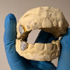 Real Diamonds 10K Gold Single Cap Custom Grillz (Choose Any Tooth)