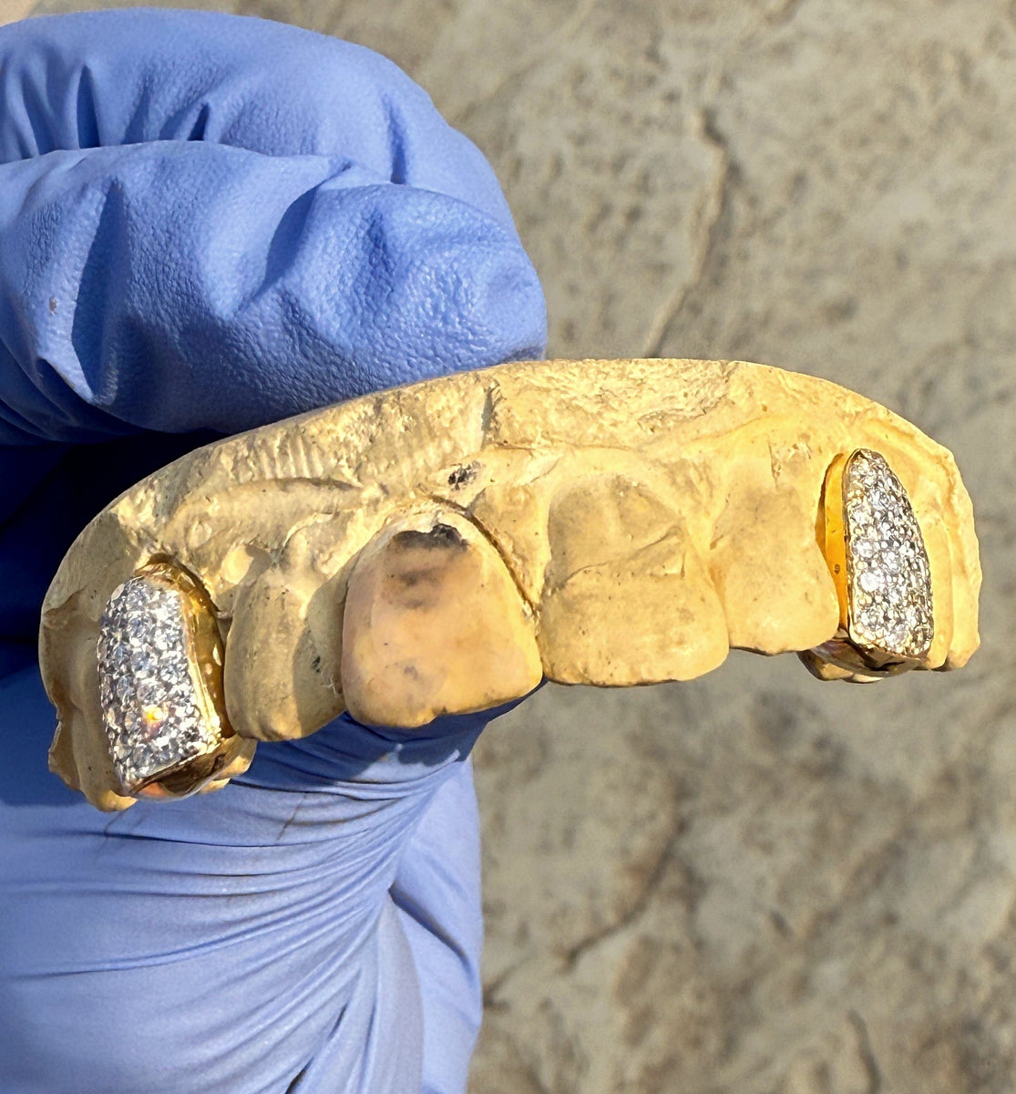 Gold Tooth Crown With Diamond